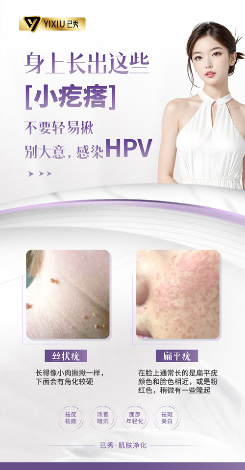 已秀减肥店怎么招来顾客